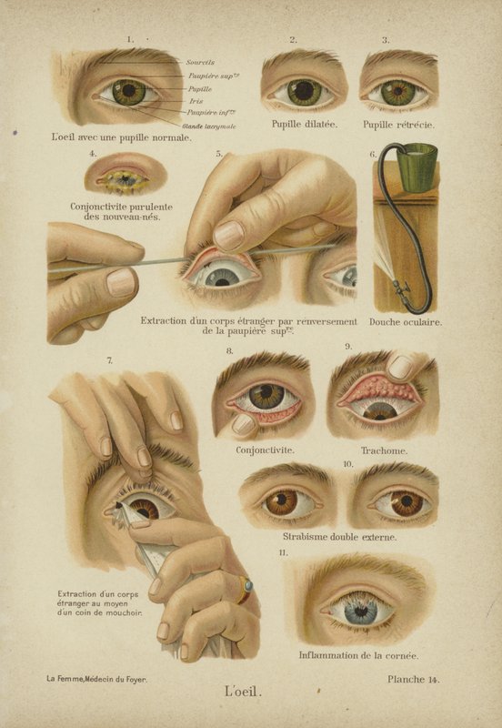 The Eye by German School