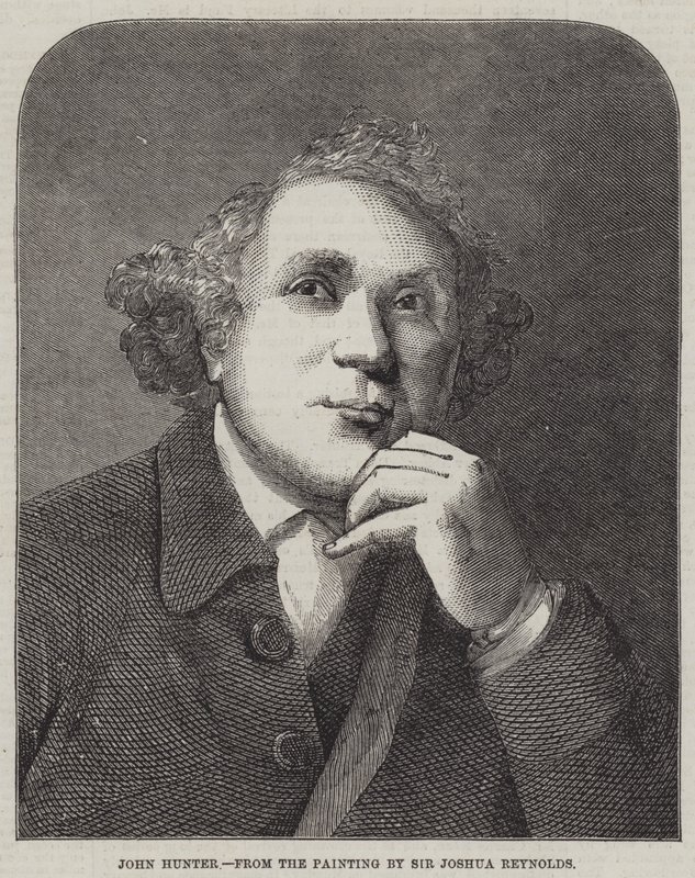 John Hunter by Joshua Reynolds