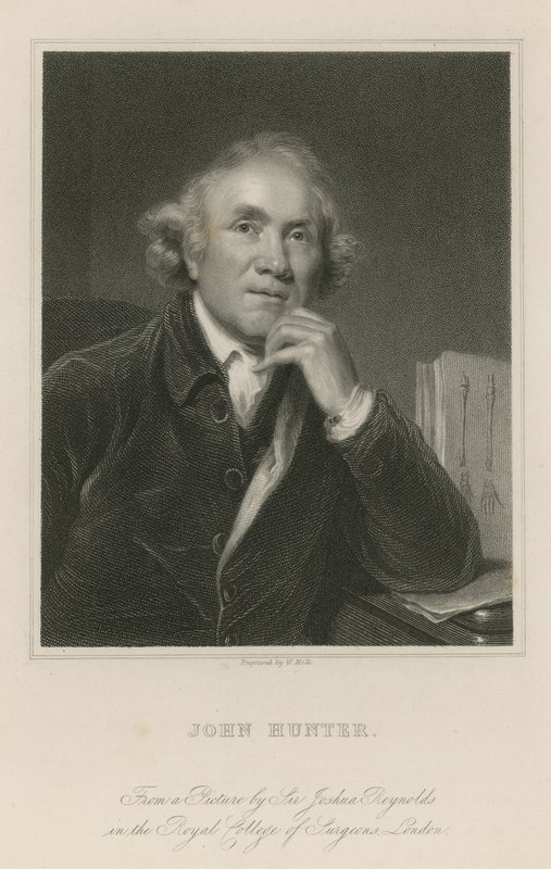 John Hunter by Joshua Reynolds